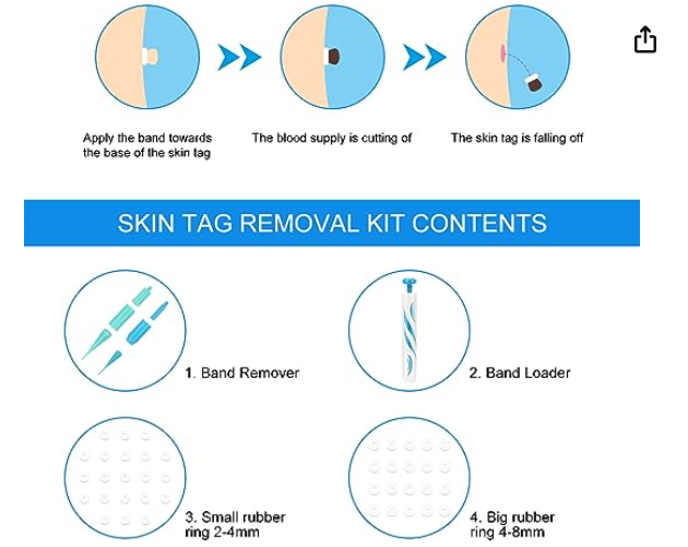 Auto Skin Tag Removal Kit